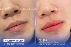 Chị Trúc Mai (32 tuổi) - Phun Môi Flora