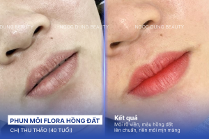 Phun môi flora hồng đất
