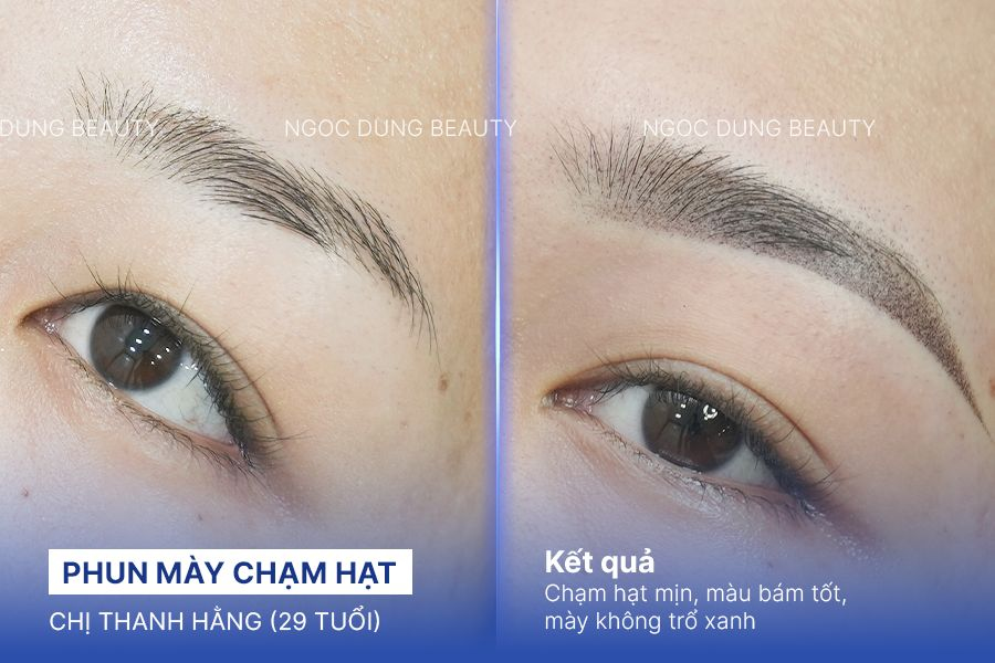 Chị Thanh Hằng (29 tuổi) - Phun Mày Chạm Hạt