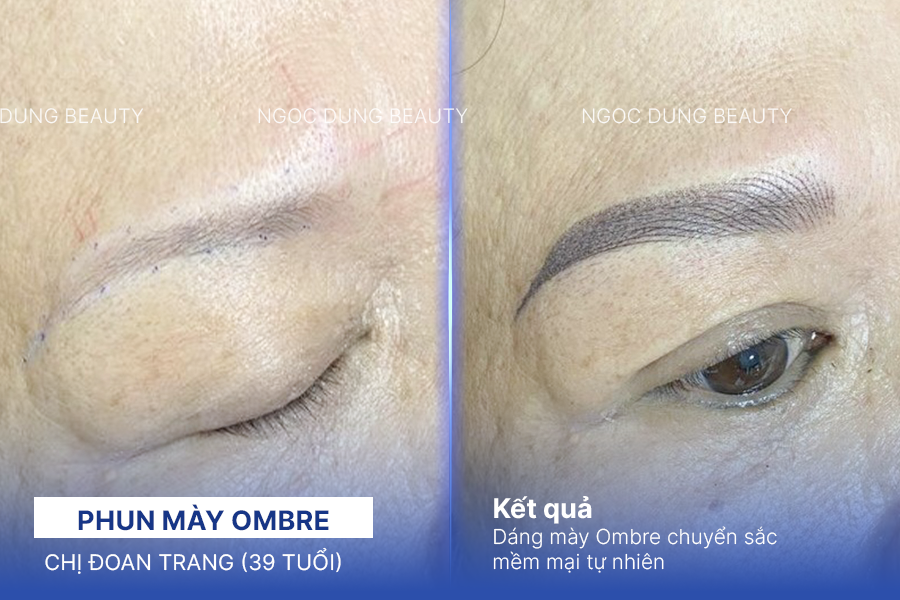 Chị Đoan Trang (39 tuổi) - Phun mày Ombre