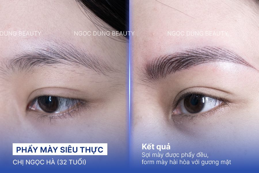 Chị Ngọc Hà (32 tuổi) - Phẩy Mày Siêu Thực