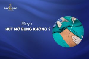 Hút mỡ bụng là gì?