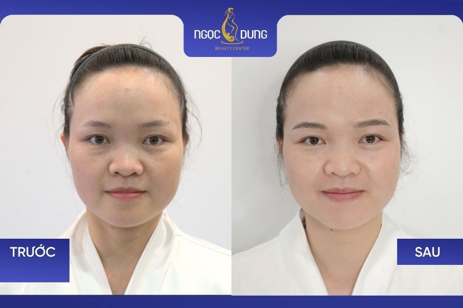 Kết quả phun xăm chân mày tại TMV Ngọc Dung