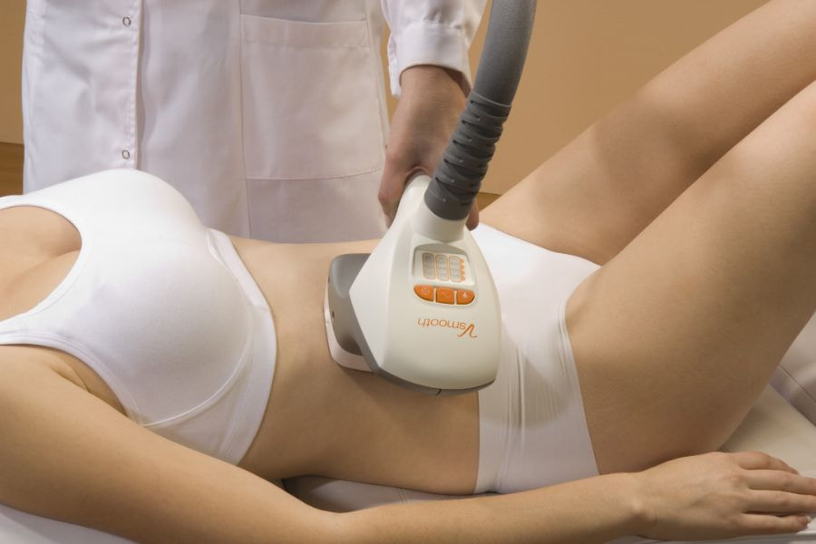 Máy giảm mỡ bụng bằng công nghệ RF