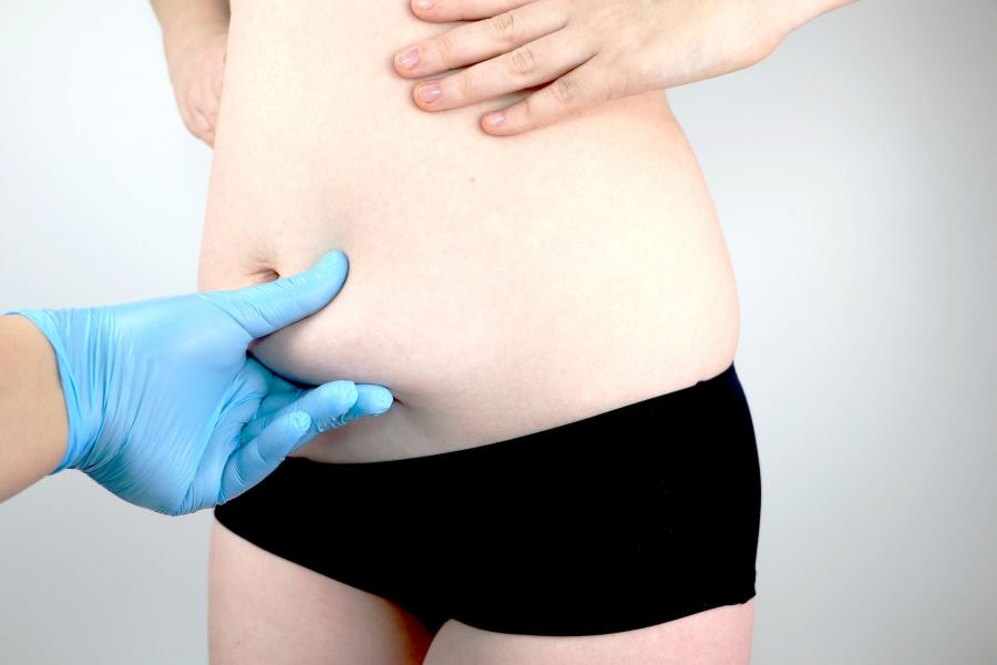Hút mỡ bụng có đau không? Toàn bộ quy trình bạn cần biết 10 Sau hút mỡ bụng, hãy tái khám thường xuyên để theo dõi kết quả và sức khỏe tổng thể