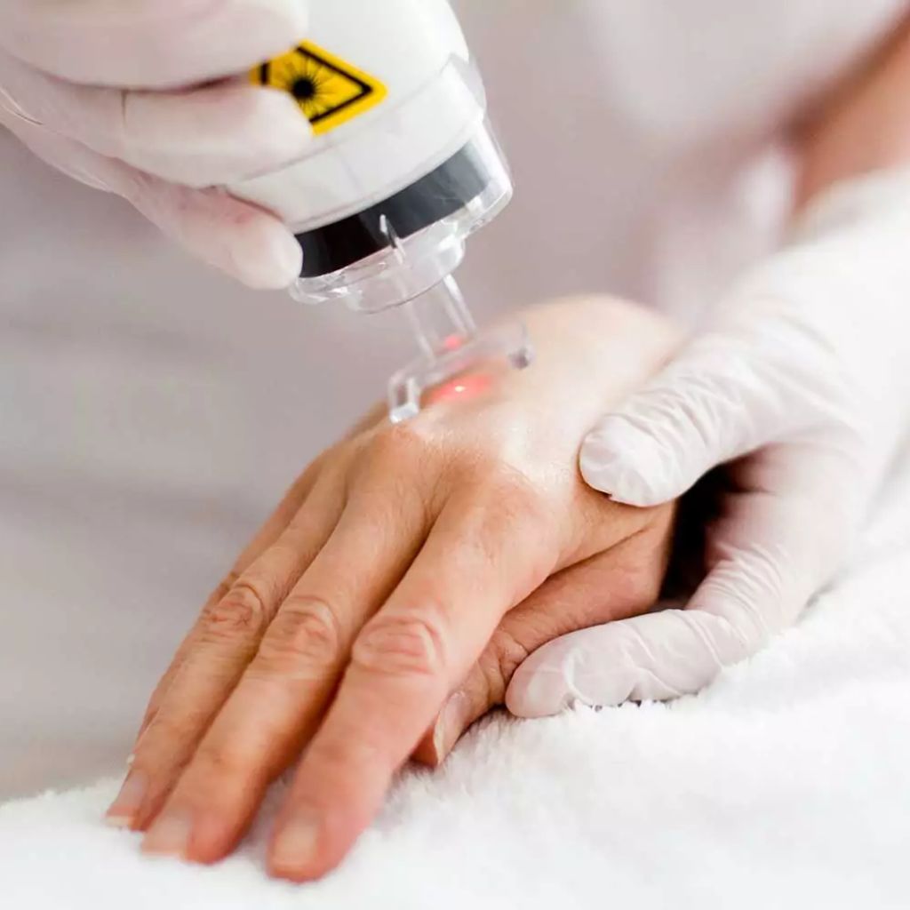 Trẻ hóa da tay công nghệ cao