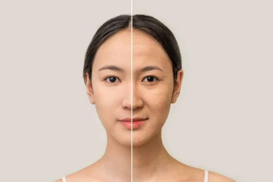 Lão hóa là một trong những nguyên nhân hàng đầu làm da mất đi độ căng bóng