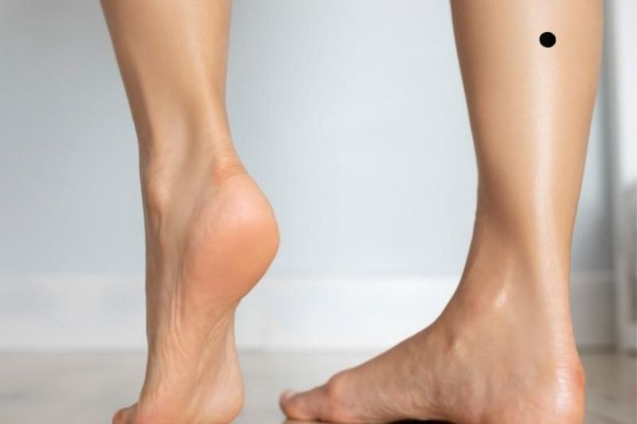 Nốt ruồi ở bắp chân cũng mang ý nghĩa đặc biệt về vận mệnh của một người theo góc nhìn nhân tướng học