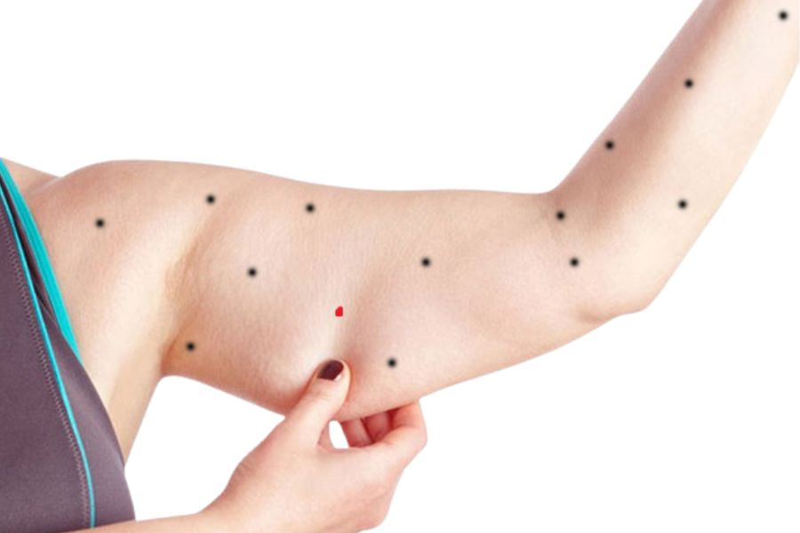 Nốt ruồi ở bắp tay trái thường mang các luận giải nhân tướng học về tính cách