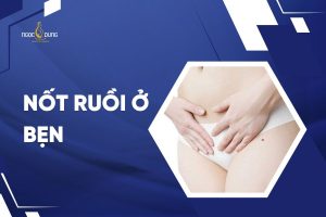 nốt ruồi ở banner