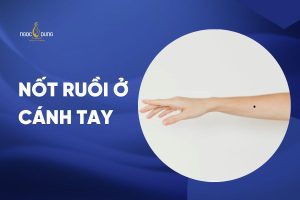 Nốt ruồi ở cánh tay nói lên điều gì về tính cách bạn?