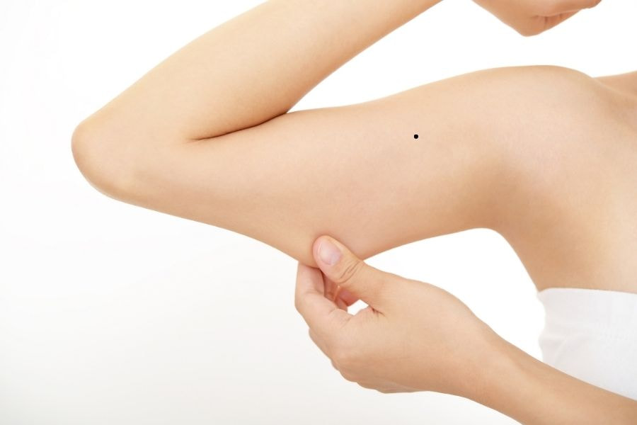 Nốt ruồi ở cánh tay nói lên điều gì về tính cách bạn? 2 Nốt ruồi ở cánh tay là một hiện tượng sinh lý bình thường