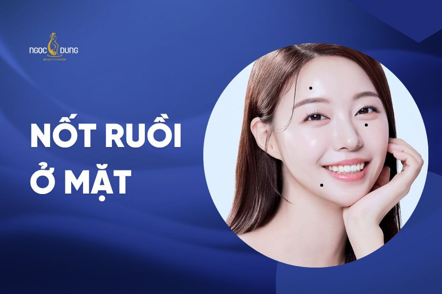 nốt ruồi trên mặt