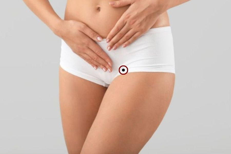 Nốt ruồi ở vùng tam giác phụ nữ có phải tướng quý hiếm? 7 Việc quan sát kỹ nốt ruồi kết hợp với đặc điểm cơ thể và vận trình cá nhân là điều cần thiết khi giải mã ý nghĩa thật sự