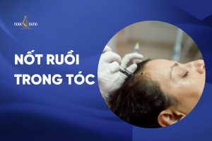 not ruoi trong toc banner