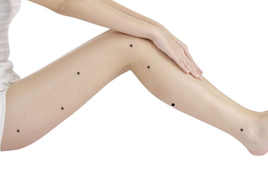 Nốt ruồi ở từng vị trí trên bắp chân sẽ mang những ý nghĩa về vận mệnh khác nhau