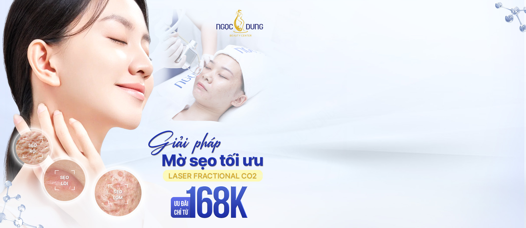 ưu đãi trị sẹo