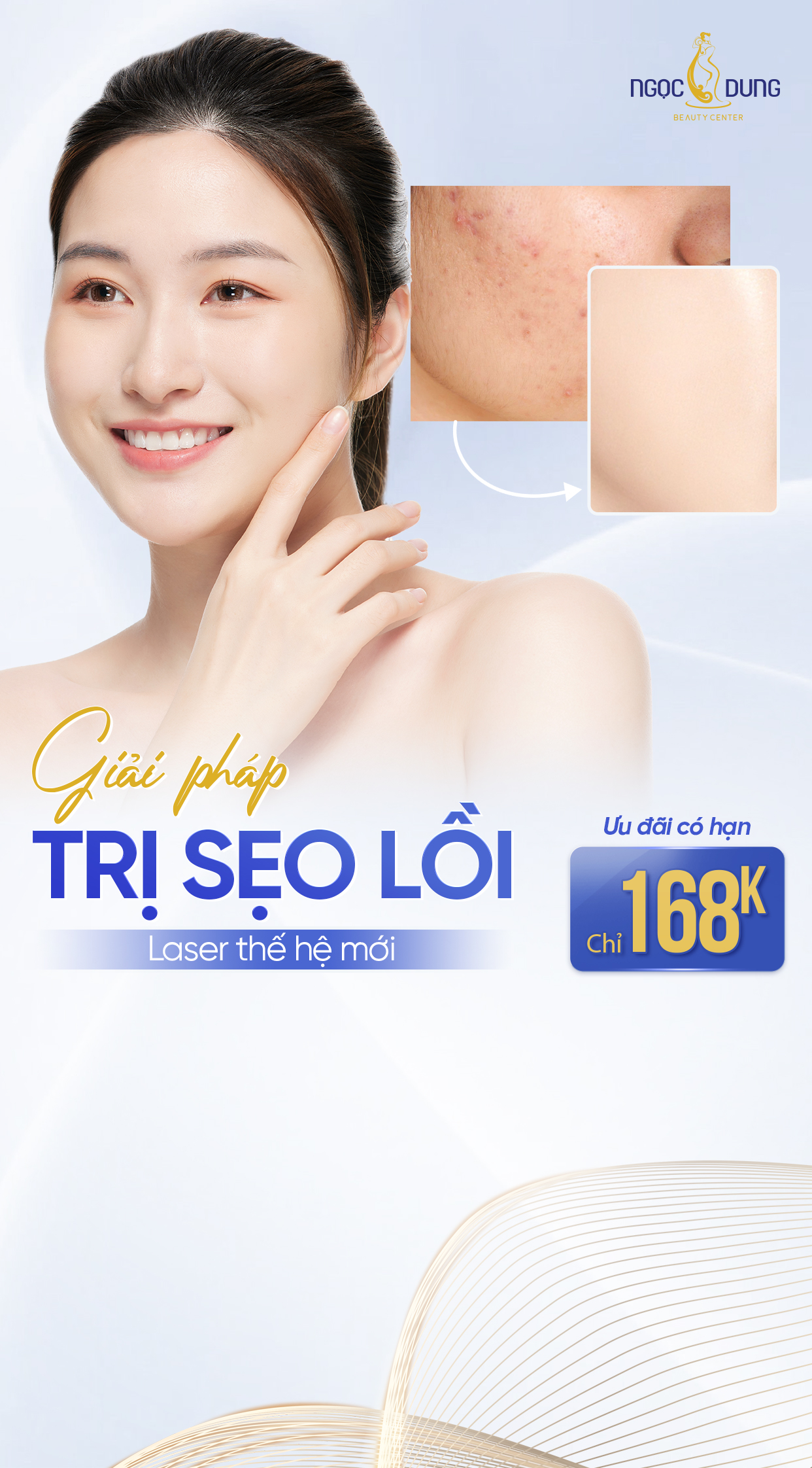 ưu đãi trị sẹo lồi mobile