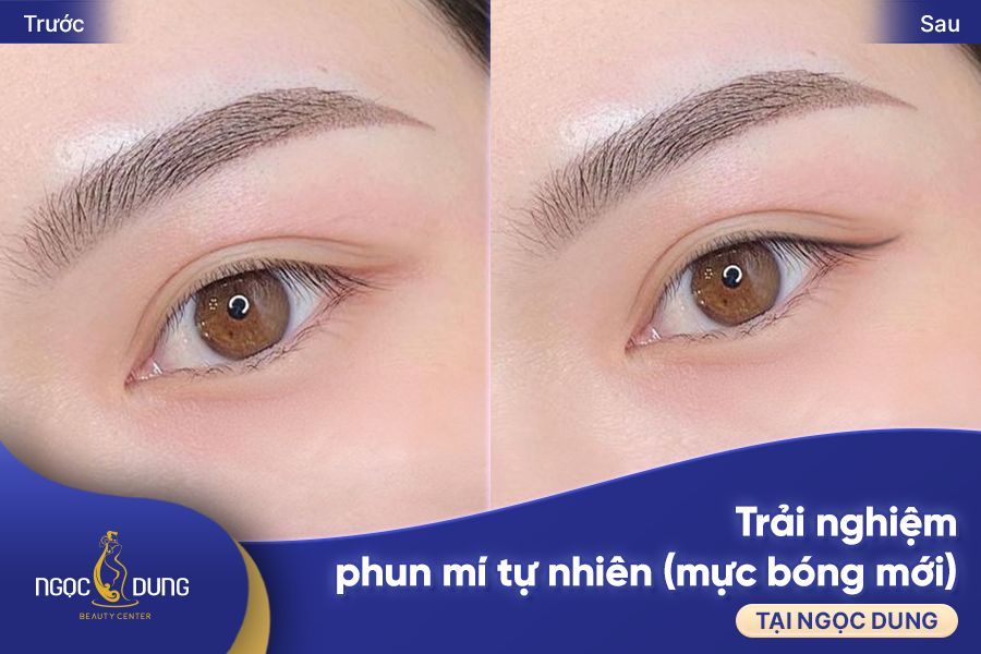 ket qua truoc va sau phun mi mat tu nhien