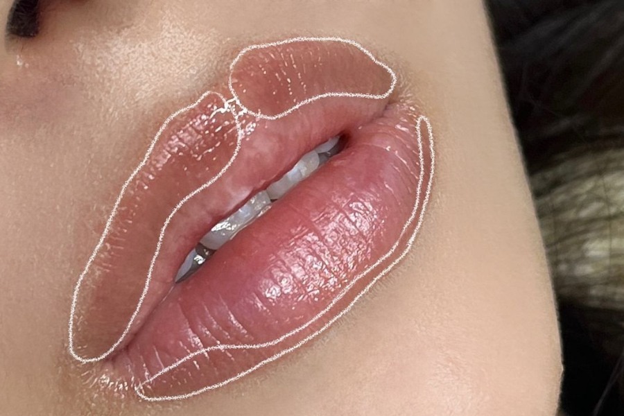 Môi thâm khiến gương mặt trở nên kém sắc