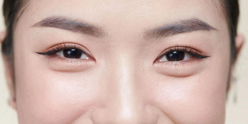 Cách trị bọng mắt bằng muối tại nhà hiệu quả, an toàn 16 Nên điều trị bọng mắt sớm để lấy lại đôi mắt tươi trẻ