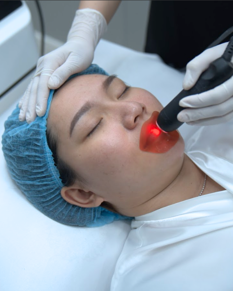 duong moi truoc di laser