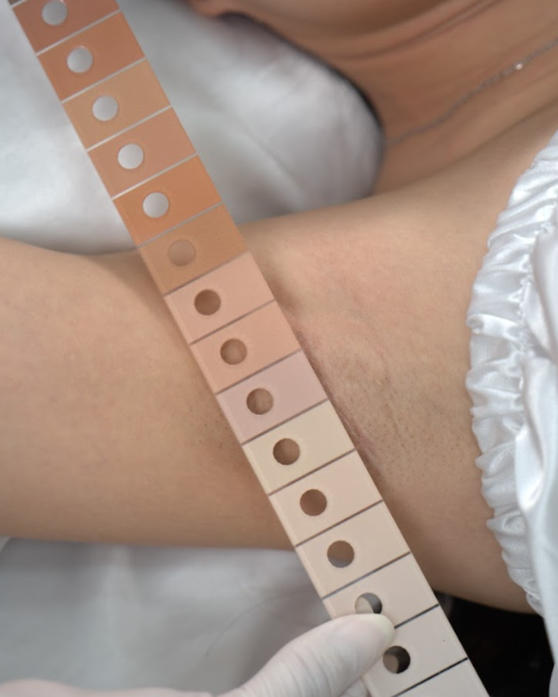 huong dan cham soc truoc tri tham nach