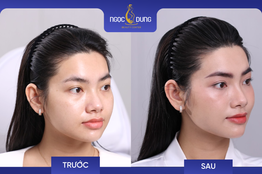 ket qua dieu khac chan may hairstroke