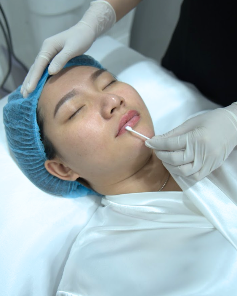 tham kham tinh trang may moi mi 2