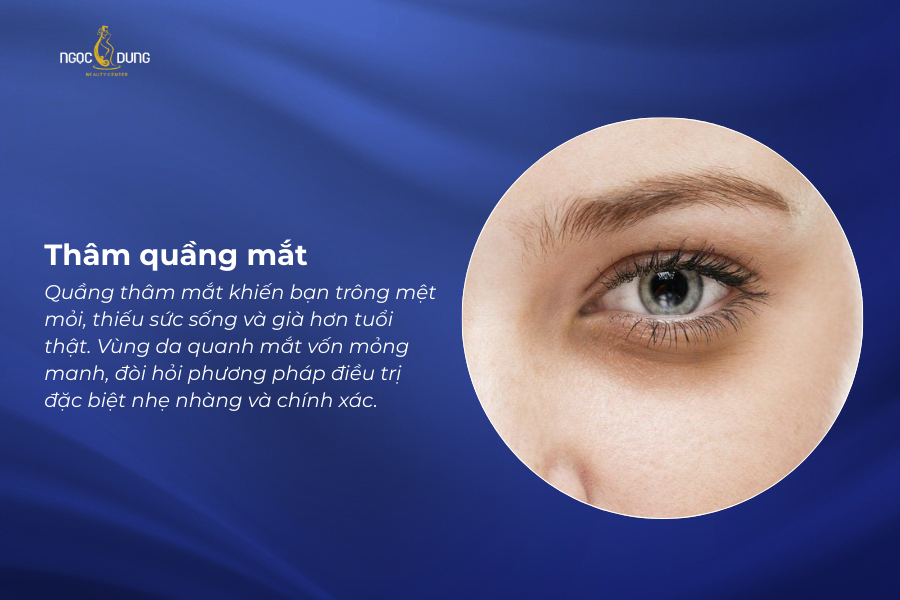 tham quang mat la gi 1