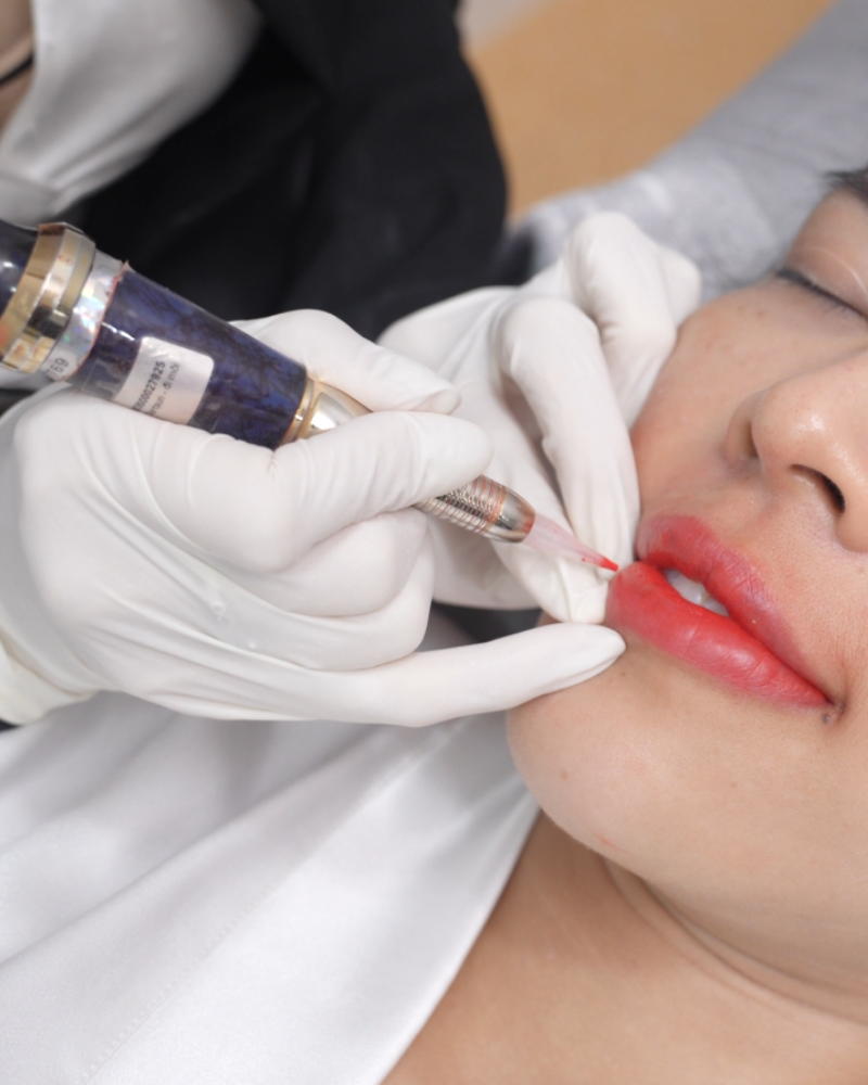 tien hanh phun moi collagen